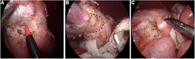 Clinical Characteristics of Gastric Duplication in Children